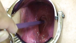 Elmer的妻子极端speclum-肛门目瞪口呆了 kak1