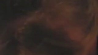 意外射液